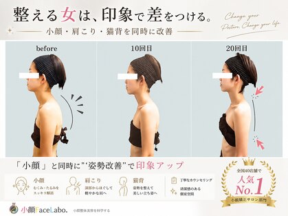 小顔フェイスラボ 新潟店(小顔FaceLabo.)の写真