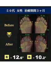 サラ(SARA)/