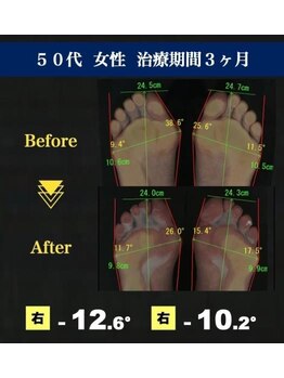 サラ(SARA)/