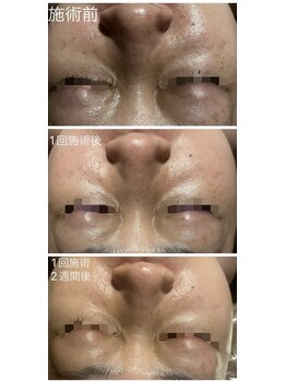 サロンドシェリ 人形町 水天宮前/