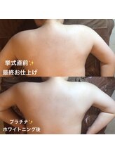 ディア スプリーマ/ブライダルエステ★最終お仕上げ