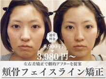 モアフェイス 池袋店(More Face)