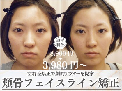 モアフェイス 池袋店(More Face)の写真