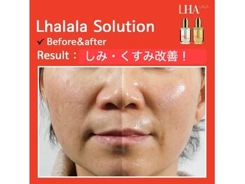 アムズ(Am’s)/【ララピール】発光肌育成