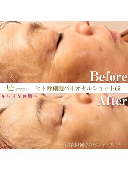 エスプリ 銀座店/シミたるみ改善・ホワイトニング