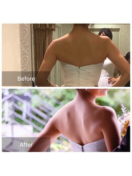 ローズボディ 恵比寿店/背中ブライダルエステ☆天使の羽