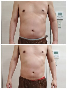 全身脱毛専門店 ten/Fit Carving