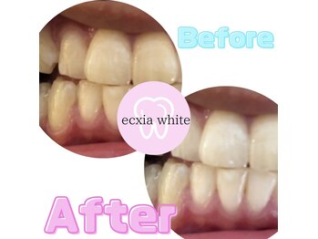 エクシアホワイト SOKA(ecxia white)/