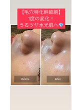 アスボーテ 月島(As Beaute’)/水光肌に♪