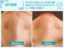 フローフシ∞/【毛穴洗浄】毛穴の黒ずみ改善