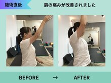 トミーリハ整体院(TOMMY REHA整体院)/肩の痛み改善