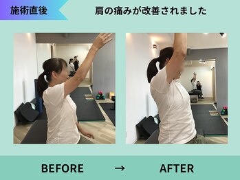 トミーリハ整体院(TOMMY REHA整体院)/肩の痛み改善
