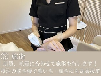 インベスト(INVEST)/施術