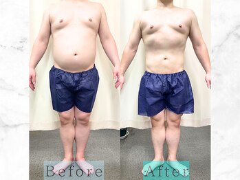 パラディ(PARADIS)/ハイパーナイフ/シェイプ