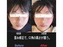 美容矯正サロン レレポノ(LELEPONO)/