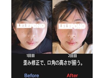 美容矯正サロン レレポノ(LELEPONO)/