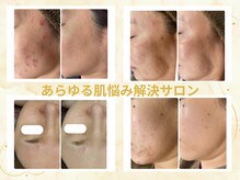 レーヴプラス 苫小牧店(REVE+)