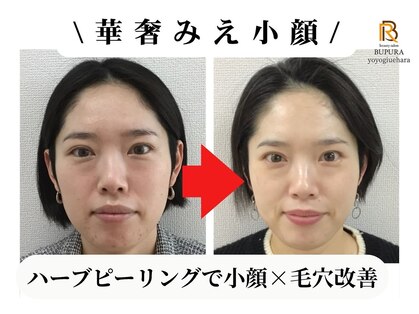 ブプラ 代々木上原店(BUPURA)の写真