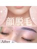 【女性限定】印象アップ★眉ワックス＋全顔脱毛 ¥6,800