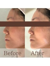 凪眠/張り・弾力UPでスッキリ若見え◎