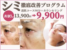 スイッチ(Switch)の雰囲気(ずっと悩んでたシミの改善なら、まずはしっかりカウンセリングを)