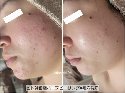 サロンドリー(salon de Re)の写真