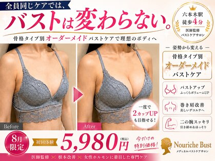 ナリッシュバスト(Nouriche Bust)の写真