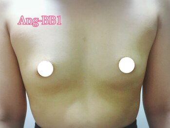 アンジェリークBB バストパレット本店/初回【Ang-BB1ケース】20代後半