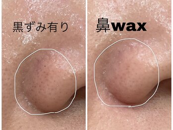 ドレス 薬院(DRESS.)/フェイシャルワックス