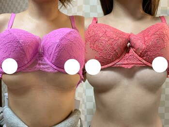 ハレオラ(HaleOla)/お客様の変化☆バストケア