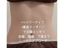 ユー(YU)の雰囲気（1度でスッキリ。上半身ハイパーナイフ＋痩身リンパマッサージ）