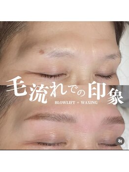 フルアナ(Hu ruana)/ハリウッドブロウリフト