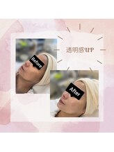 CPヴィアン 本店/透明感アップ