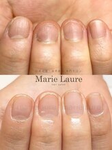 マリーロール 梅田店(Marie Laure)/深爪矯正/自爪育成/自爪風