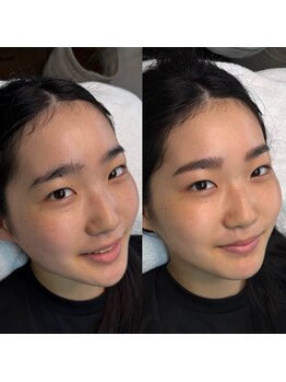 マナ ワクシング 海浜幕張(Mana waxing)/ツヤ肌wax/フェイシャルwax/幕張