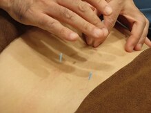 フミ鍼灸院の雰囲気（[柔整×鍼灸資格保持]プロによる本物の施術です）