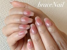 ブレスネイル(brace Nail)