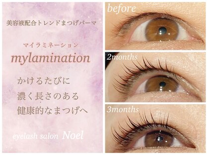 ノエル 下北沢(Noel)の写真