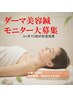 【先着３名限定】３か月で本気の肌質改善！！ダーマ美容鍼モニター募集