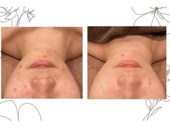 レゴリス 横浜店(REGOLITH)/