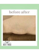 オークツリー(oak tree)/Before After