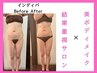 【インディバモニター】夏に向けてダイエットしたい方！モニター様募集！