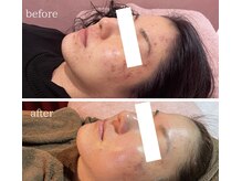 メンズ シンバ(SIMBA)/☆ ビフォーアフター ☆