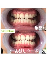 ルブラン 奈良店(Le Blanc)/海外へ行く前に！男性のお客様