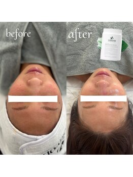 ヌン(NUN.)/韓国肌管理volayonベルドソ