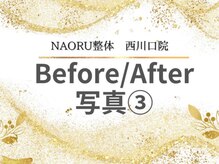 ナオル整体 西川口院(NAORU整体)/ 西川口 蕨 戸田 整体 骨盤矯正