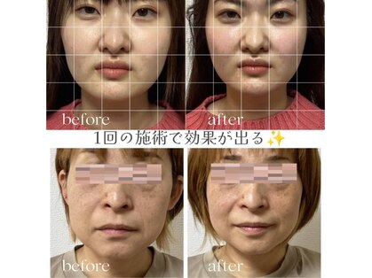 小顔整体 優の写真