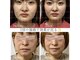 小顔整体 優の写真