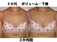 バストサロン メルベイユ(Merveile)/バスト位置UP、ボリュームUP