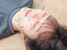 Facial Rejuvenation Acupuncture　60min JPY12800→10880
